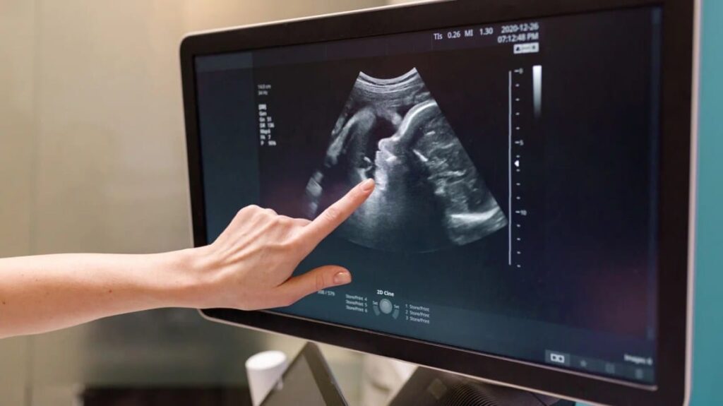 detailed ultrasound image 1296x728 header